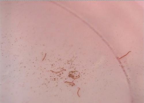 自来水中含活体虫,自来水中含活体虫吗